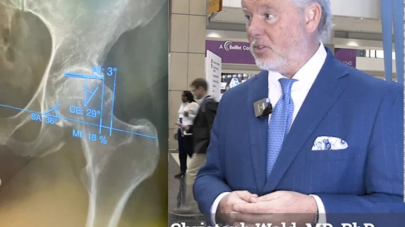 Video Christoph Wald explains how the Health AI Challenge help understand how foundational AI models work