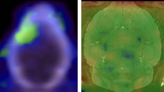 ALS drug repurposed for PET imaging