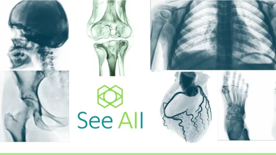 See All AI