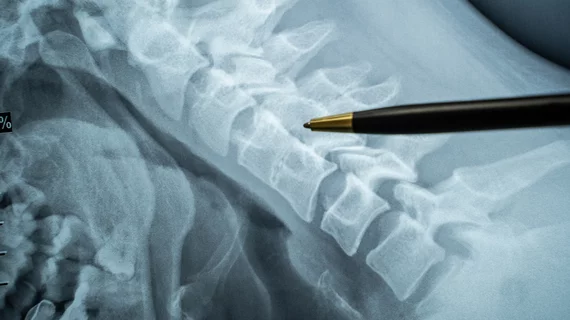 Spine X-ray spinal cord