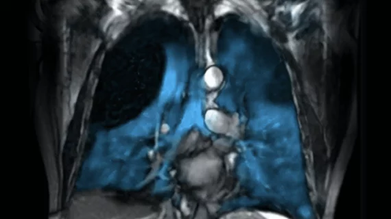 FDA approves expanded use of Xenoview for lung imaging
