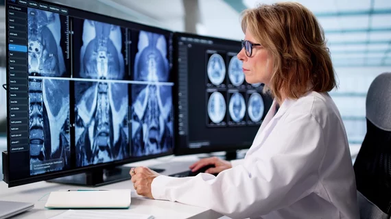 MRI Scans