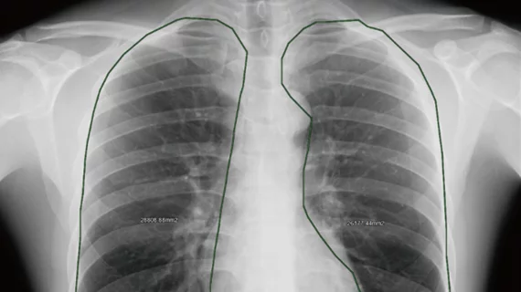 Dynamic chest radiography could potentially replace pulmonary function ...