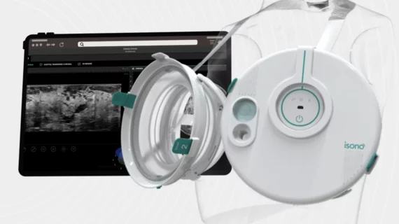 iSono Health announces commercial launch of portable, wearable breast ultrasound device