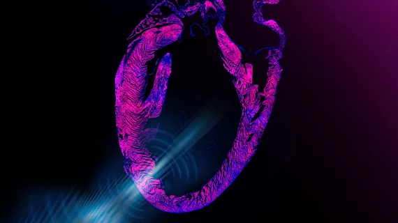 ultrasound pacemaker