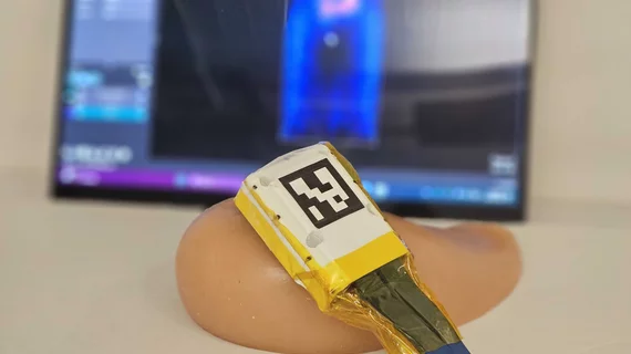 MIT cancer ultrasound