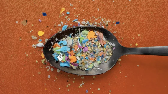 Microplastics can be seen on MRI