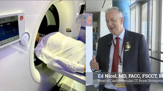 Ed Nicol, MD, FACC, FSCCT, MBA, head of cardiovascular CT at Royal Brompton Hospital in London and a former SCCT president, said AI has tremendous potential to improve imaging workflows. However, unlike screening tests that carry little or no risk, cardiac computed tomography (CT) exposes patients to ionizing radiation, requiring physician oversight and careful justification before scans are performed. #SCCT