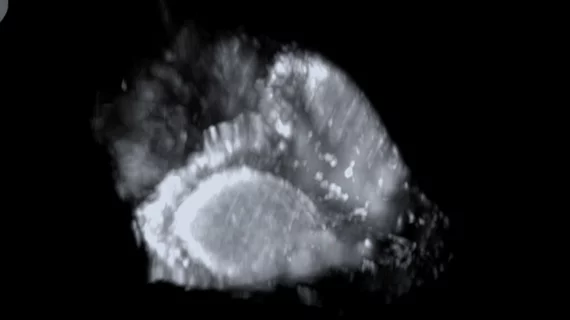 Imaging system tracks seizures in real time