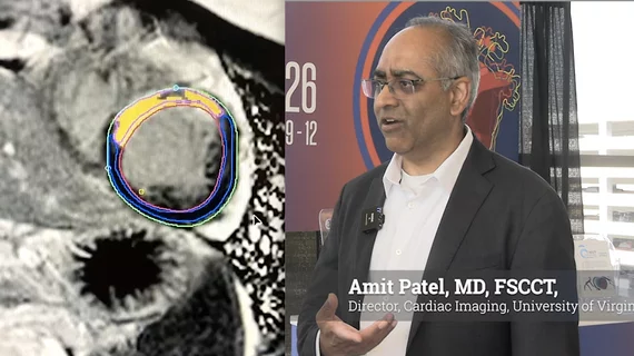 Amit Patel, MD, FSCCT, secretary of the Society for Cardiovascular Magnetic Resonance (SCMR), director of cardiac imaging and professor of medicine at the University of Virginia Health System in Charlottesville, outlined four key areas where cardiac MRI is expanding its clinical value, along with the growing role of artificial intelligence (AI) in making advanced imaging techniques more practical for routine clinical use. #CMR #SCMR #CardiacMR