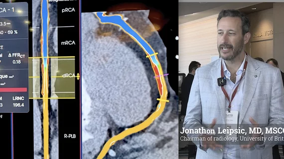 Jonathon Leipsic, MD, MSCCT, FRCPC, chairman of radiology, and a professor of radiology and cardiology, University of British Columbia, Canada, explains some of the key technical developments in coronary CT angiogram (CCTA) plaque imaging, which has seeing rapid adoption. #SCCT #TCT #YesCCT
