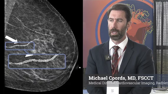 Michael Coords, MD, FSCCT, medical director of cardiovascular imaging at RadNet, explains what the new Maryland law requires when when breast artery calcifications are found in mammograms that indicate the patient may have higher risk of cardiovascular disease.