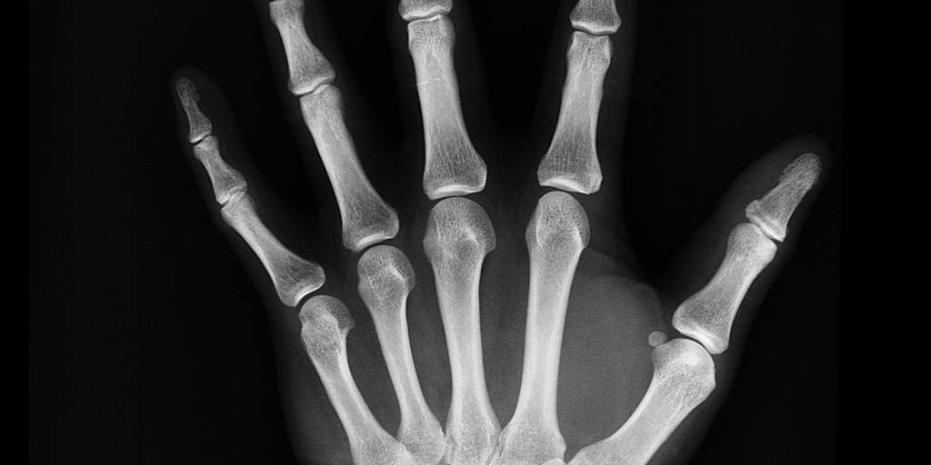 How to tell if you need an x-ray - Envision Radiology