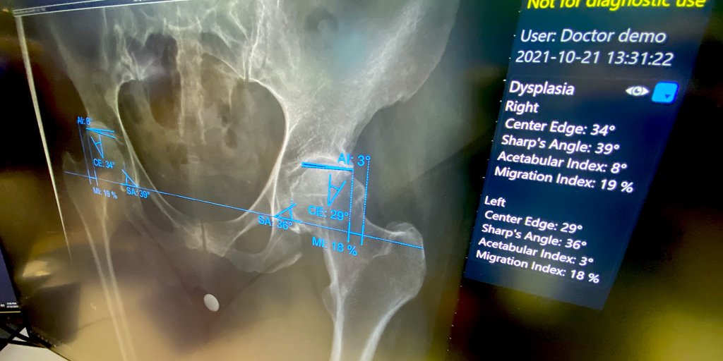 AI in Radiology