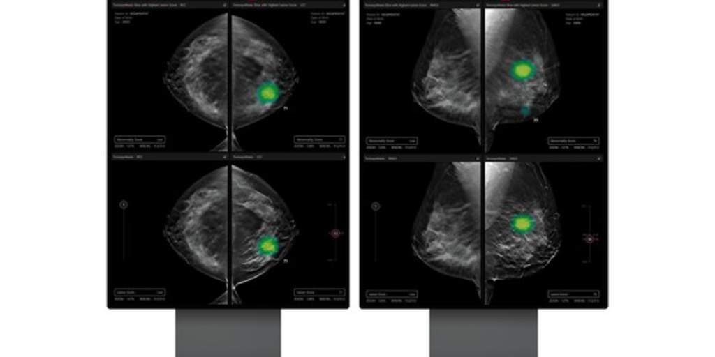 Lunit AI-powered 3D breast imaging receives FDA clearance